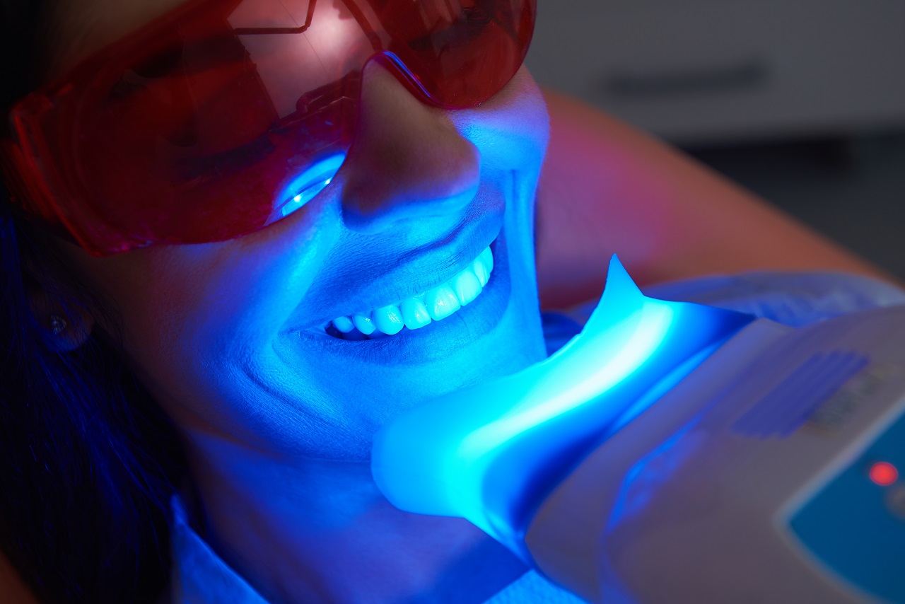 Zabiegi poprawiające biel zębów